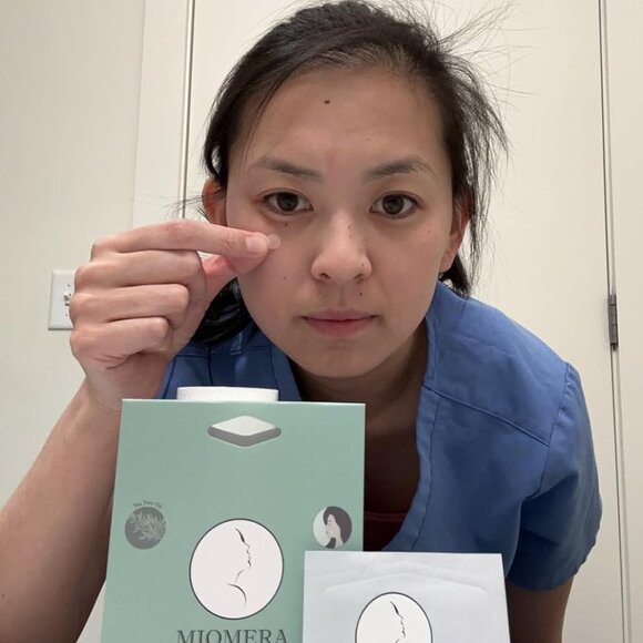 Brand new - pimple patches - Picture 6 of 7